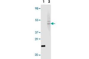 Western blot analysis using FBLN5 monoclonal antibody, clone 3F10A5, 3F8A12  against truncated recombinant FBLN5 (Lane 1) and HeLa cell lysate (Lane 2). (Fibulin 5 抗体)