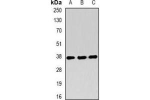 Western blot analysis of RING1b expression in Jurkat (A), SHSY5Y (B), mouse testis (C) whole cell lysates.