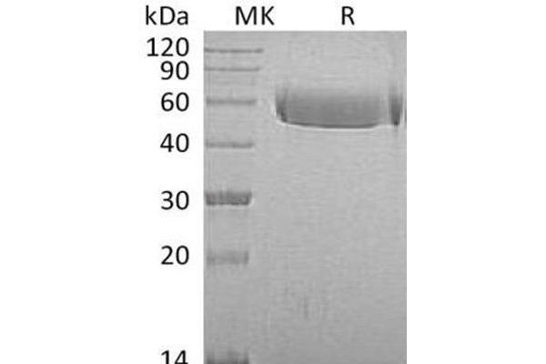 Fetuin A Protein (His tag)