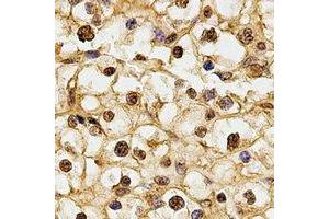 Immunohistochemistry (IHC) image for anti-Ribosomal Protein S5 (RPS5) antibody (ABIN7308294) (RPS5 抗体)