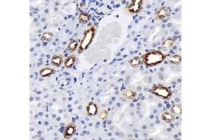 Immunohistochemistry (Paraffin-embedded Sections) (IHC (p)) image for anti-Mal, T Cell Differentiation Protein 2 (MAL2) antibody (ABIN7074549)