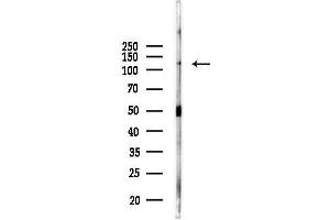 Western blot analysis of lysates from Rat brain, using VE-Cadherin Antibody at 1/1000 dilution.
