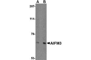 Western blot analysis of NIPSNAP in human brain tissue lysate with AP30032PU-N NIPSNAP antibody at (A) 0. (AIFM3 抗体  (N-Term))