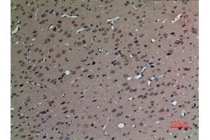 Immunohistochemistry (IHC) analysis of paraffin-embedded Rat Brain, antibody was diluted at 1:100. (SV2C 抗体  (Internal Region))