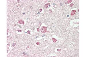 Anti-PDE2 / PDE2A antibody IHC staining of human brain, cortex. (PDE2A 抗体)