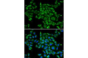 Immunofluorescence analysis of U2OS cells using PRKCA antibody. (PKC alpha 抗体)