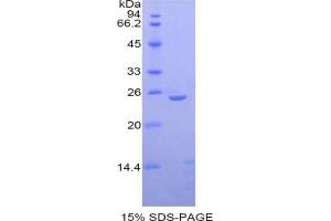 SDS-PAGE analysis of IL27 Protein. (IL-27 蛋白)