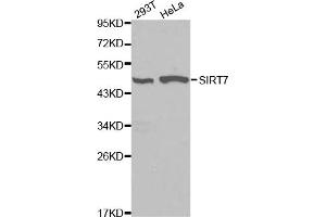 Western blot analysis of extracts of various cell lines, using SIRT7 antibody. (SIRT7 抗体)