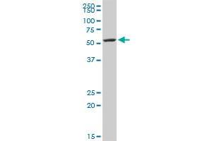 KRT5 MaxPab rabbit polyclonal antibody. (Cytokeratin 5 抗体  (AA 1-590))