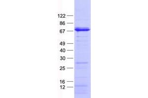 Western Blotting (WB) image for Ets Variant 4 (ETV4) protein (His tag) (ABIN2712284)