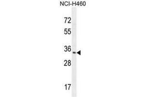 RNT2 Antibody (N-term) western blot analysis in NCI-H460 cell line lysates (35µg/lane). (RNASET2 抗体  (N-Term))