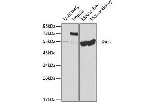 Western blot analysis of extracts of various cell lines using PAH Polyclonal Antibody at dilution of 1:1000. (Phenylalanine Hydroxylase 抗体)