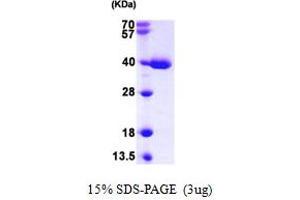 SDS-PAGE (SDS) image for Thioredoxin-Like 1 (TXNL1) (AA 1-289) protein (His tag) (ABIN667868) (TXNL1 Protein (AA 1-289) (His tag))