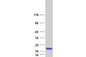 Western Blotting (WB) image for Peptidyl-tRNA Hydrolase Domain Containing 1 (PTRHD1) protein (Myc-DYKDDDDK Tag) (ABIN2714099)