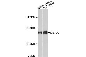 Western blot analysis of extracts of various cell lines, using MEIOC antibody.