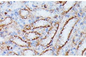 Immunohistochemistry of paraffin-embedded Rat kidney using IDH3A Polyclonal Antibody at dilution of 1:100 (40x lens). (IDH3A 抗体)