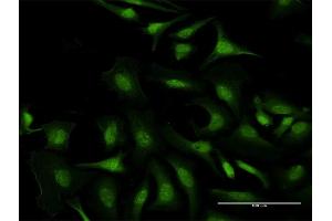 Immunofluorescence of purified MaxPab antibody to C5orf51 on HeLa cell. (C5orf51 抗体  (AA 1-294))