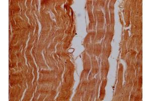 Immunohistochemistry of paraffin-embedded human adrenal gland tissue using ABIN7162253 at dilution of 1:100 (OFD1 抗体  (AA 598-771))