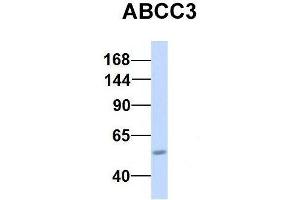 Host:  Rabbit  Target Name:  CHAD  Sample Type:  Human Adult Placenta  Antibody Dilution:  1. (ABCC3 抗体  (Middle Region))