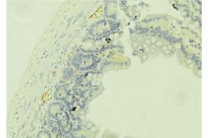 ABIN6279350 at 1/100 staining Mouse colon tissue by IHC-P. (DHRS9 抗体  (Internal Region))