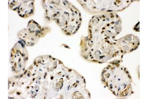 Anti- GRK5 Picoband antibody,IHC(P) IHC(P): Human Placenta Tissue (GRK5 抗体  (C-Term))