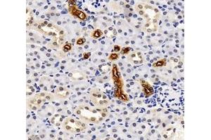 Immunohistochemistry (Paraffin-embedded Sections) (IHC (p)) image for anti-Solute Carrier Family 12 (Sodium/potassium/chloride Transporters), Member 1 (SLC12A1) antibody (ABIN7075651)