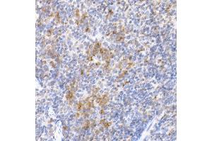 Immunohistochemistry of paraffin-embedded mouse spleen using MDH2 Rabbit mAb (ABIN7268381) at dilution of 1:25 (40x lens). (MDH2 抗体)