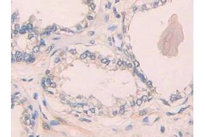 Used in DAB staining on fromalin fixed paraffin- embedded rectum cancer tissue (IL1R1 抗体  (AA 226-318))