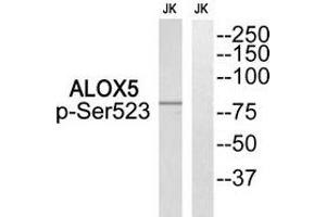 Western blot analysis of extracts from Jurkat cells, using ALOX5 (Phospho-Ser523) antibody. (ALOX5 抗体  (pSer523))