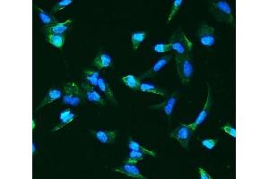 IF analysis of ANGPT2 using anti-ANGPT2 antibody (ABIN7601450). (Angiopoietin 2 抗体  (AA 357-404))