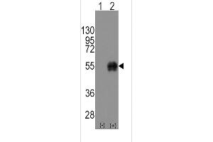 Western blot analysis of CD14 using rabbit polyclonal CD14 Antibody using 293 cell lysates (2 ug/lane) either nontransfected (Lane 1) or transiently transfected with the CD14 gene (Lane 2). (CD14 抗体  (C-Term))