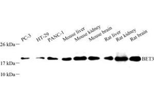 Western blot analysis of BET3 (ABIN7075949) at dilution of 1: 500 (TRAPPC3 抗体)