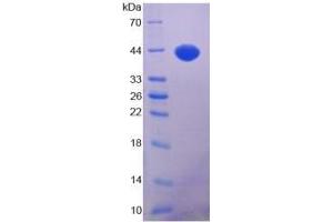 SDS-PAGE of Protein Standard from the Kit (Highly purified E. (IGF1 CLIA Kit)