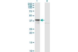 Western Blot analysis of DNAJB6 expression in transfected 293T cell line by DNAJB6 monoclonal antibody (M02), clone 2D12-B9. (DNAJB6 抗体  (AA 1-241))