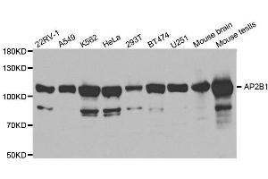 Western blot analysis of extracts of various cell lines, using AP2B1 antibody. (AP2B1 抗体  (AA 752-951))
