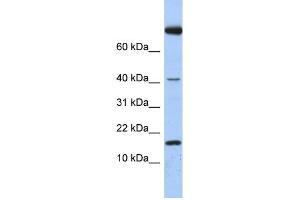 WB Suggested Anti-IL4 Antibody Titration: 0. (IL-4 抗体  (Middle Region))