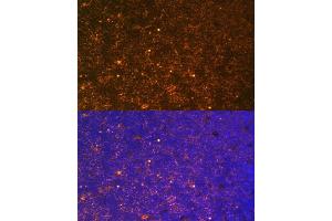 Immunofluorescence analysis of Rat thymus using CTGF antibody (ABIN6127716, ABIN6139187, ABIN6139190 and ABIN6215053) at dilution of 1:100. (CTGF 抗体  (AA 27-349))