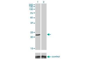 Western blot analysis of FXN over-expressed 293 cell line, cotransfected with FXN Validated Chimera RNAi (Lane 2) or non-transfected control (Lane 1). (Frataxin 抗体  (AA 91-200))