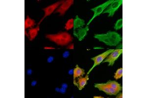 ABIN6264582 and ABIN6279743 staining HepG2 cells by IF/ICC. (RAB40C 抗体  (C-Term))