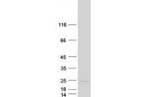 Validation with Western Blot