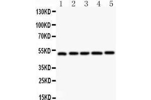 Anti- NR1H3 antibody,  Western blotting All lanes: Anti NR1H3 () at 0. (NR1H3 抗体  (C-Term))
