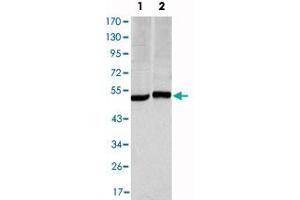 Western blot analysis using CA9 monoclonal antibody, clone 2D3  against HeLa (1) and A-549 (2) cell lysate. (CA9 抗体)