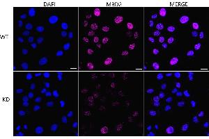 Immunocytochemical staining of HT- cells using MBD2 antibody (ABIN7799387), 1:1,000), Top panel: wild-type (WT), Bottom panal: MBD2 shRNA knockdown (KD). (Recombinant MBD2 抗体)