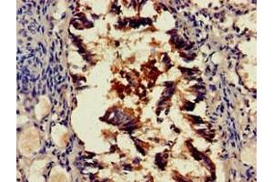 Immunohistochemistry of paraffin-embedded human lung tissue using ABIN7168699 at dilution of 1:100 (SCTR 抗体  (AA 51-135))