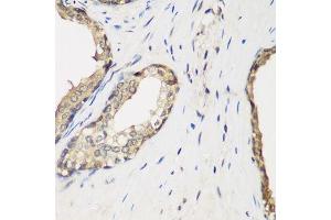 Immunohistochemistry of paraffin-embedded human prostate using METTL7A antibody. (METTL7A 抗体  (AA 30-244))