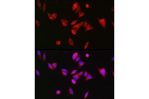Immunofluorescence analysis of Hep G2 cells using BAAT Rabbit pAb (ABIN6131367, ABIN6137411, ABIN6137412 and ABIN6223563) at dilution of 1:200 (40x lens).