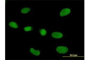 Immunofluorescence of purified MaxPab antibody to RPP40 on HeLa cell. (RPP40 抗体  (AA 1-244))