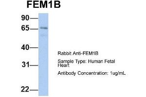 Host: Rabbit  Target Name: FEM1B  Sample Tissue: Human Fetal Heart  Antibody Dilution: 1. (FEM1B 抗体  (C-Term))