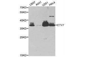 Western blot analysis of extracts of various cell lines, using ETV7 antibody (ABIN5973686) at 1/1000 dilution. (ETV7 抗体)