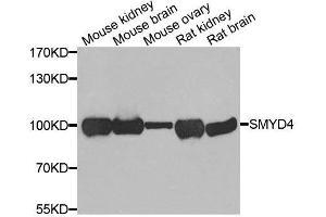 Western blot analysis of extracts of various cell lines, using SMYD4 antibody. (SMYD4 抗体  (AA 1-260))